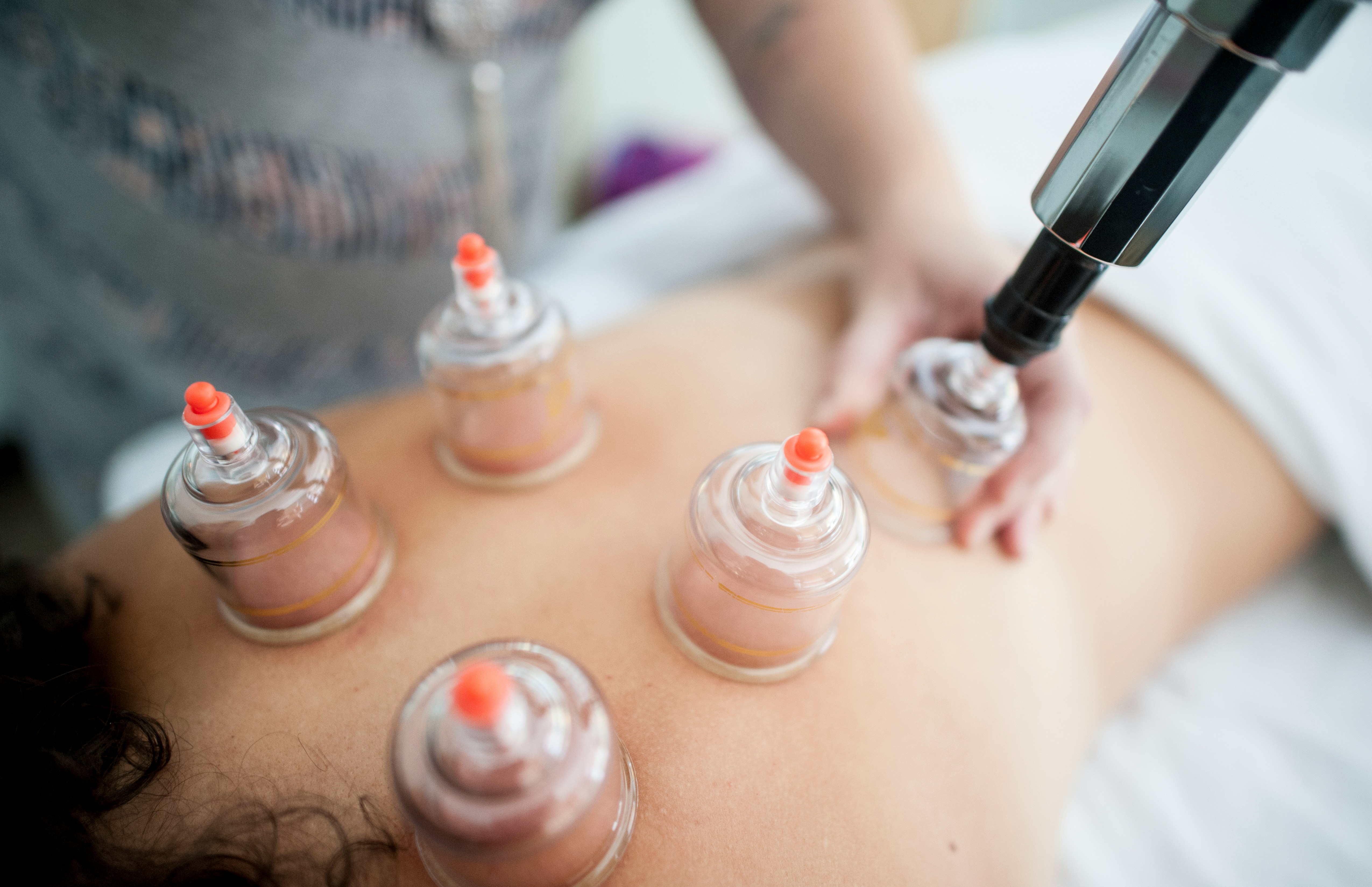 Cupping Therapy Massage
